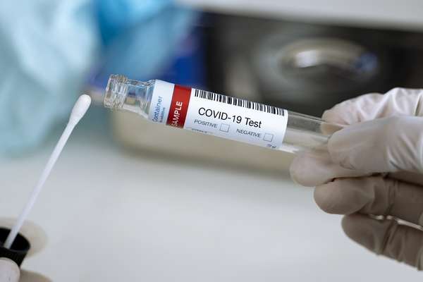 Coronavirus au Bénin : Les tests de dépistage PCR désormais possibles que sur prescription médicale
